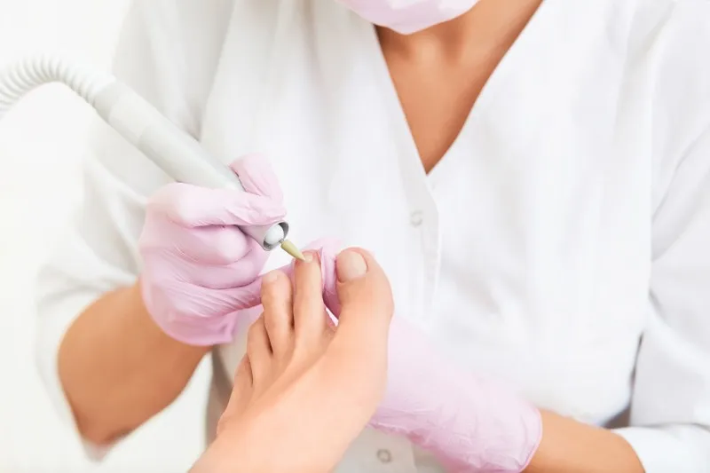 Spezielle Nagelbehandlung, Mykose und eingewachsene Nägel